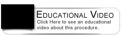 Dental Education Video - Porcelain Veneers